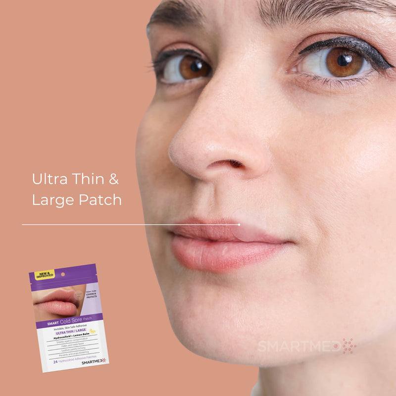 [Australia] - Smart Cold Sore Treatment Patch - Large 15mm Soothe Itching and Burning - Skin Safe Adhesive Thin with Lemon Balm 