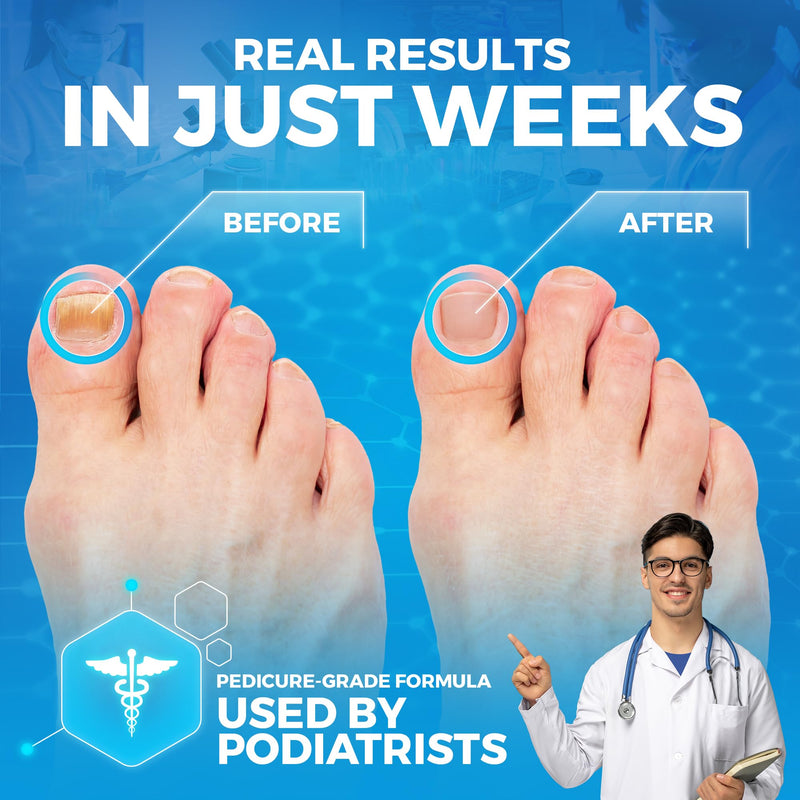 [Australia] - Epsom Salt Foot Soak w Tea Tree for Foot Bath (PEDICURE GRADE) - Toenail Repair, and Fungus Athletes Foot, Softens Calluses, Tired Feet, Nail Discoloration Foot Soak Salts, Smelly Foot Therapy16oz 