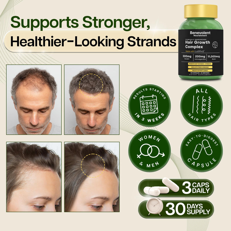Benevolent Lustriva Hair Growth Supplement with Keratin & Biotin – 90 Count | Advanced Hair Vitamins for Thicker-Looking, Stronger Strands, Support for Stress-Related Thinning in Women & Men 90 Count (Pack of 1)