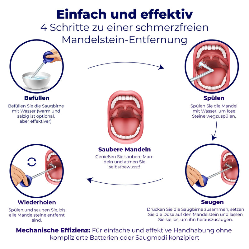[Australia] - Oravix tonsil stone cupping glass, tonsil stone removal suction, combat bad breath, tonsil stone remover, tonsil stone remover suction, cupping glass, tonsil stone against bad breath, oral hygiene 