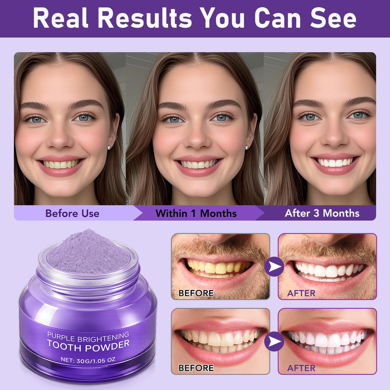 [Australia] - Teeth Whitening Powder - Toothpaste Whitening Booster Powder, No Sensitivity, Removes Stains for Coffee, Tea, Food, Wine, and Tobacco Stains 