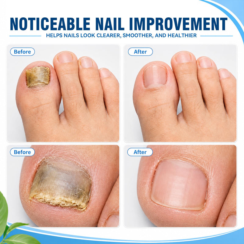 Nail Care Patches,21 Count Toenail Treatment Extra Strength Patches, Overnight Nail Appearance Care for Discolored, Thick-Looking and Rough Nails, Easy At-Home Toenail & Cuticle Routine