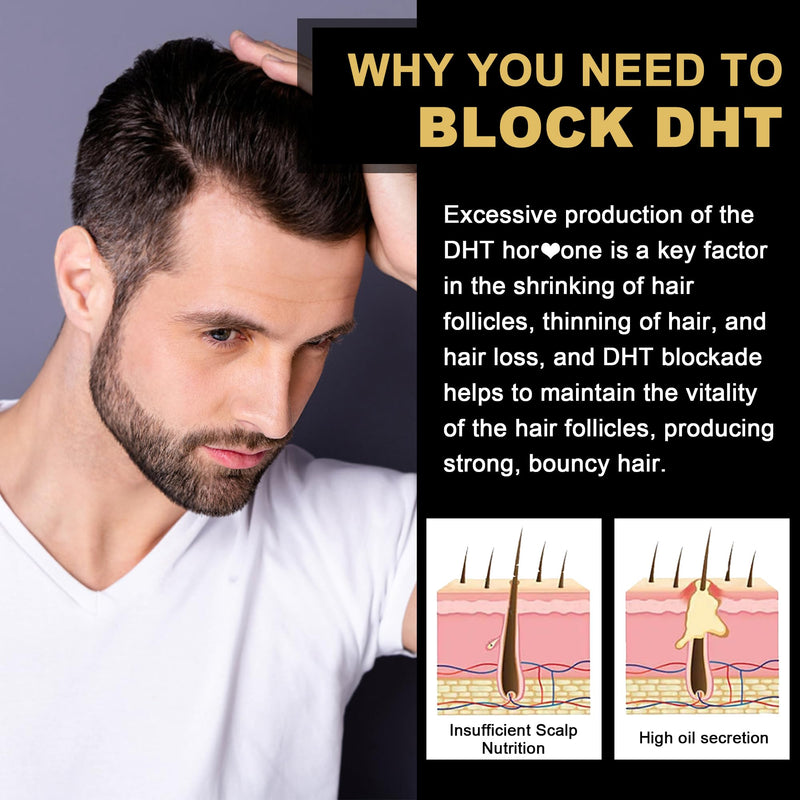 [Australia] - DHT Blocker Gummies Hair Growth Supplement, Super Potency Saw Palmetto & Biotin 10000 mcg for Women & Men, Plus 12 Proprietary Blend - Prevent Hair Loss, Blocking DHT Receptors, Hormonal Balance 60 Count (Pack of 1) 