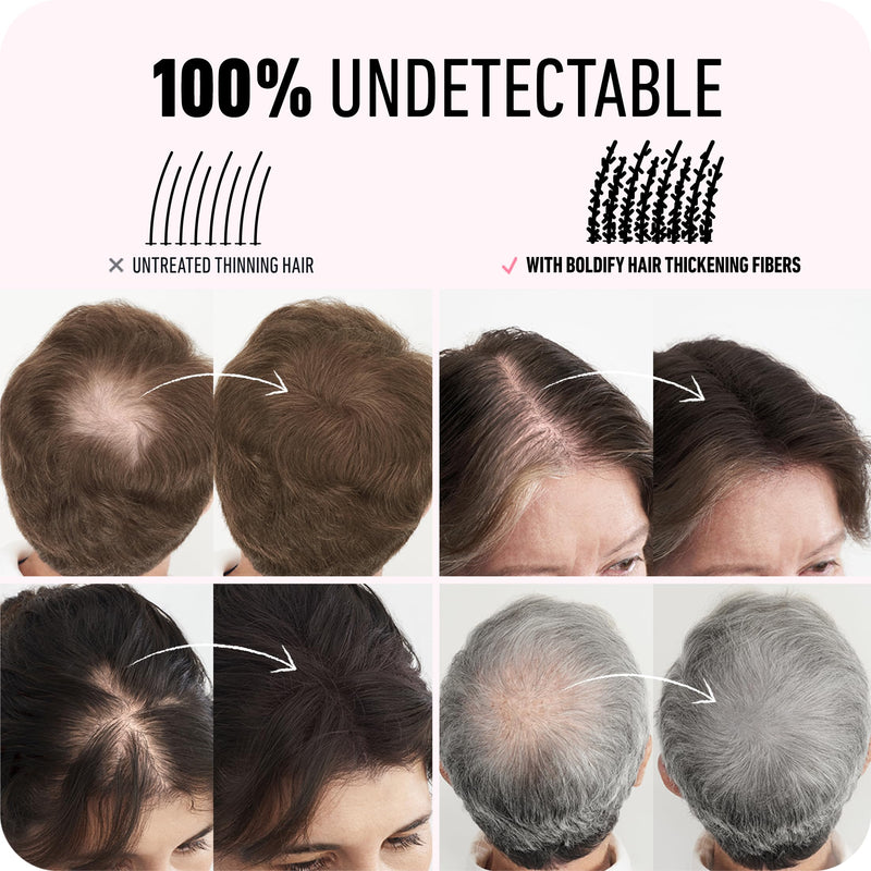 BOLDIFY Hair Fibers for Thinning Hair, for Women & Men, Dark Brown 28g | Instantly Fills Thinning & Fine Hair for a Fuller, Thicker Look - Thin Spot Cover Up - Hair Building Fibers & Hair Powder