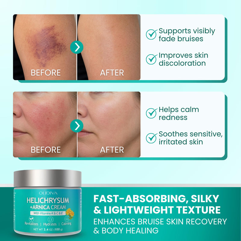 Arnica Bruise Cream | Extra Strength Arnica Cream for Bruises, Mature & Thin Skin with Helichrysum, Vitamins K, C & E | Soothes, Restores & Strengthens Skin Barrier for Adult & Senior - 3.4oz