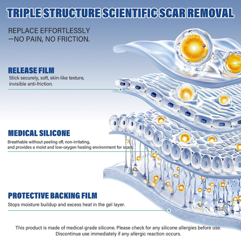 [Australia] - Silicone Scar Sheets,Silicone Scar Tape(1.6"x 158" Roll-4 meters),Silicone Scar Sheets for Surgical Scars,Keloid Bump Removal,Scar Tape for Surgical,C-Section,Tummy Tuck,Keloid Scars 