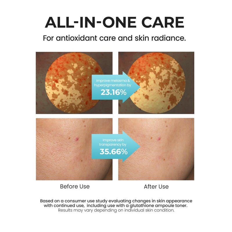 SKIN&LAB Glutathione Radiance Cream 1.69 fl oz | Cellfusome Glutathione 100,000ppm | Face Moisturizer for Dry and Sensitive Skin | Antioxidant and Brightening Care