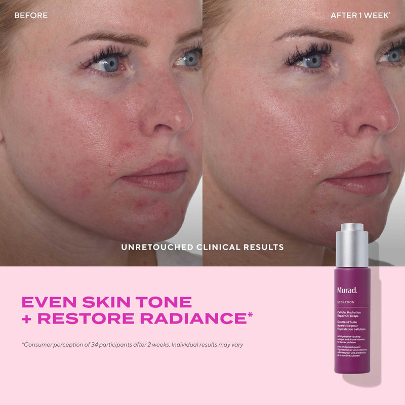 Murad Cellular Hydration Repair Oil Drops - Multi-Vitamin Blend - 1 Fl Oz | Hydrating multi-vitamin face oil with Bilberry Seed Oil strengthens the skin barrier and relieves redness for glowy skin