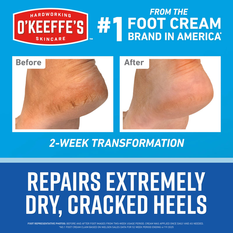 [Australia] - O’Keeffe’s for Healthy Feet Heel Repair Kit with Urea & Lactic Acid – (1 Pair) Reusable Foot Sleeves + 3 oz. Intense Renewal Foot Cream, Exfoliates & Softens Dry Heels 