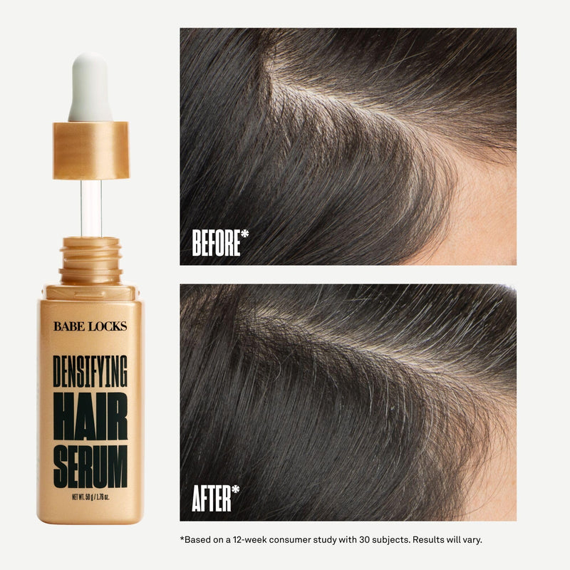 Babe Original Densifying Hair Serum for Thinning Hair | Densifying hair serum provides support for thinning hair & helps prevent hair loss for fuller, thicker-looking hair