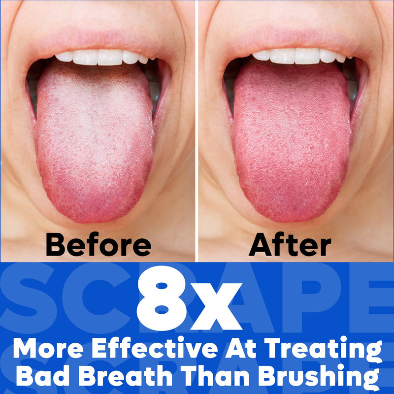 [Australia] - Tongue Scraper For Adults - Dual Head Stainless Steel Tongue Cleaner Travel Metal Case | Bad Breath Mouth Treatment | Best Disposable Metal Plastic-Free Scrubber | Oral Care Hygiene Essential Kit, 2pk Dual Scrape 