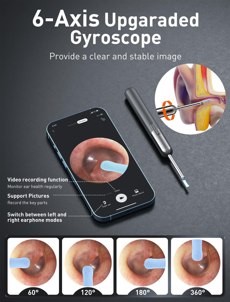 [Australia] - Qimic Earwax Remover Otoscope, WiFi Ear Cleaner with Camera, IP67 Waterproof Ear Endoscope, 360° Wide Angle Otoscope Camera with 6 LEDs for iPhone, Android Smartphones and iPad 