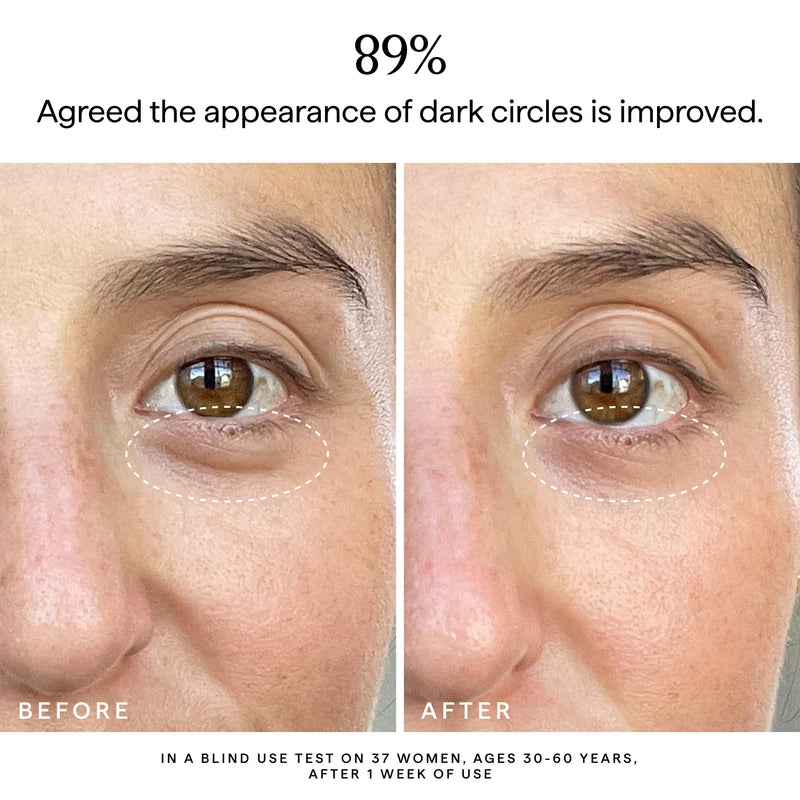 HERBIVORE Super Nova Eye Cream | Brightening with Vitamin C, 0.5 oz | Targets dark circles and puffiness with a plant-based vegan formula. Helps brighten tired-looking under eyes