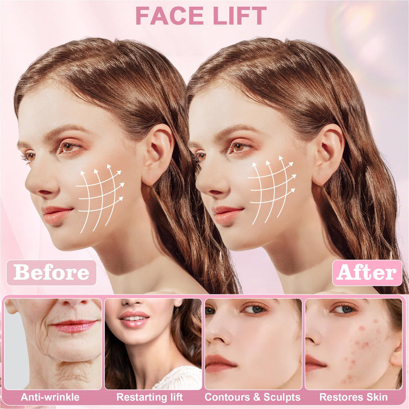 [Australia] - Chin Strap for Sleeping,Anti Snoring Chin Strap for CPAP Users,V-Line Lifting Mask,Adjustable and Breathable Chin Strap-Keep Mouth Closed for Effectively Reduce Snoring (Pink-White) Pink-white 