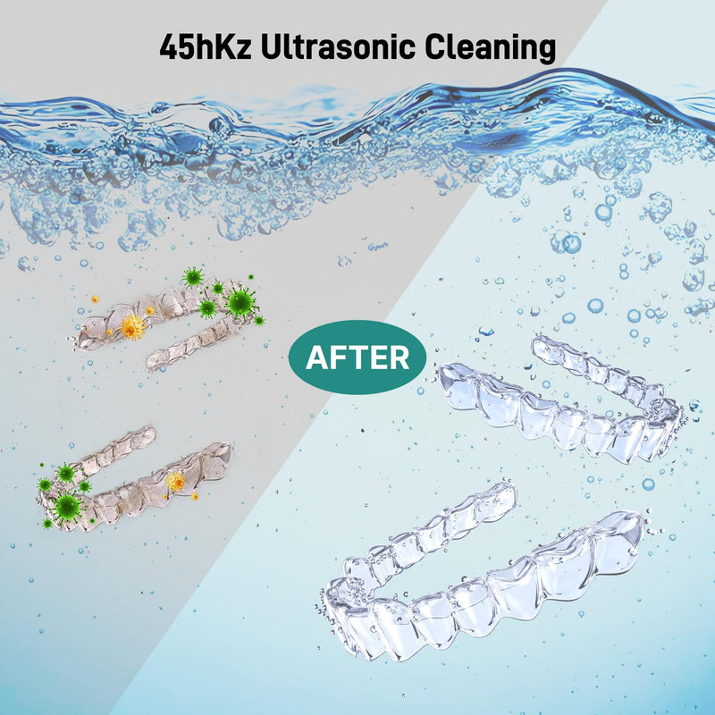 [Australia] - Ultrasonic Retainer Cleaner, Dental Cleaning Pod with U-V Lights, 45kHz Retainer Cleaner Machine for Dentures, Toothbrush Heads, Jewelry, Aligner, Night Mouth Guards (Black) Black 