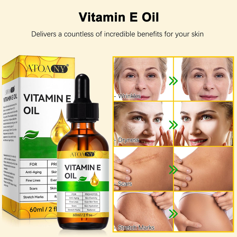Vitamin E Oil 2 Fl Oz - Vitamin E Oil for Skin, Face, Hair, Body - Natural Antioxidant for Dryness, Wrinkles, Scars & Stretch Marks, Moisturizing and Firming Skin 2 Fl Oz (Pack of 1)