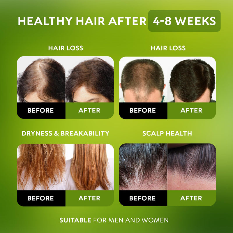 Batana Oil for Hair Growth - 100% Raw & Organic Unrefined Batana Oil - Cold Pressed Hair Mask for Scalp Health, Thicker Hair & Split Ends Repair - Natural & Pure (4.23 oz) 4.23 Fl Oz