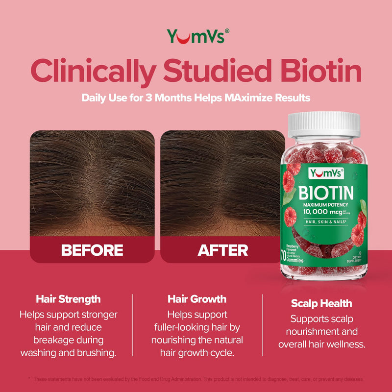 Biotin Gummies 10,000mcg – Biotin for Hair Growth Women – Great-Tasting Gummies – Hair, Skin & Nails Vitamins – Non-GMO Vegan Biotina Supplement for Women – 70 Count | Maximum Strength, Supports Hair Growth, Healthy Skin & Strong Nails, Great-Tasting, ...