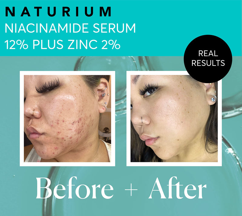 Naturium Niacinamide Face Serum 12% Plus Zinc 2% Jumbo, Anti-Aging, Pore Minimizer & Dark Spot Corrector with Hyaluronic Acid & Vitamin E, Vegan & Cruelty-Free, 2 oz 2 Fl Oz (Pack of 1)