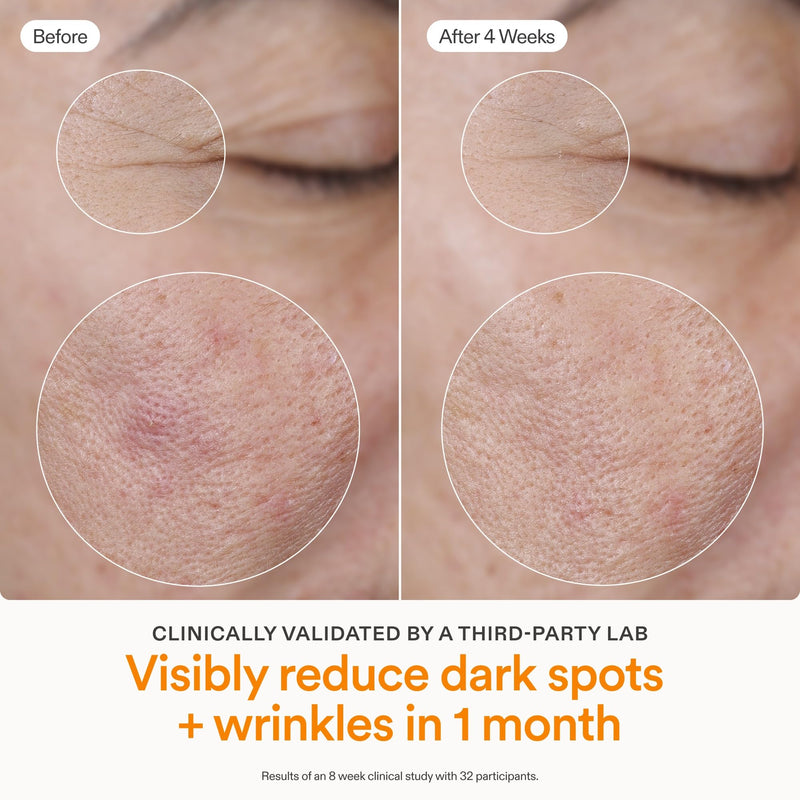 Skinfix Brighten + Firm 15% Vitamin C Serum for Face - Visibly Fades Dark Spots & Fine Lines - Safe for Sensitive & Aging Skin