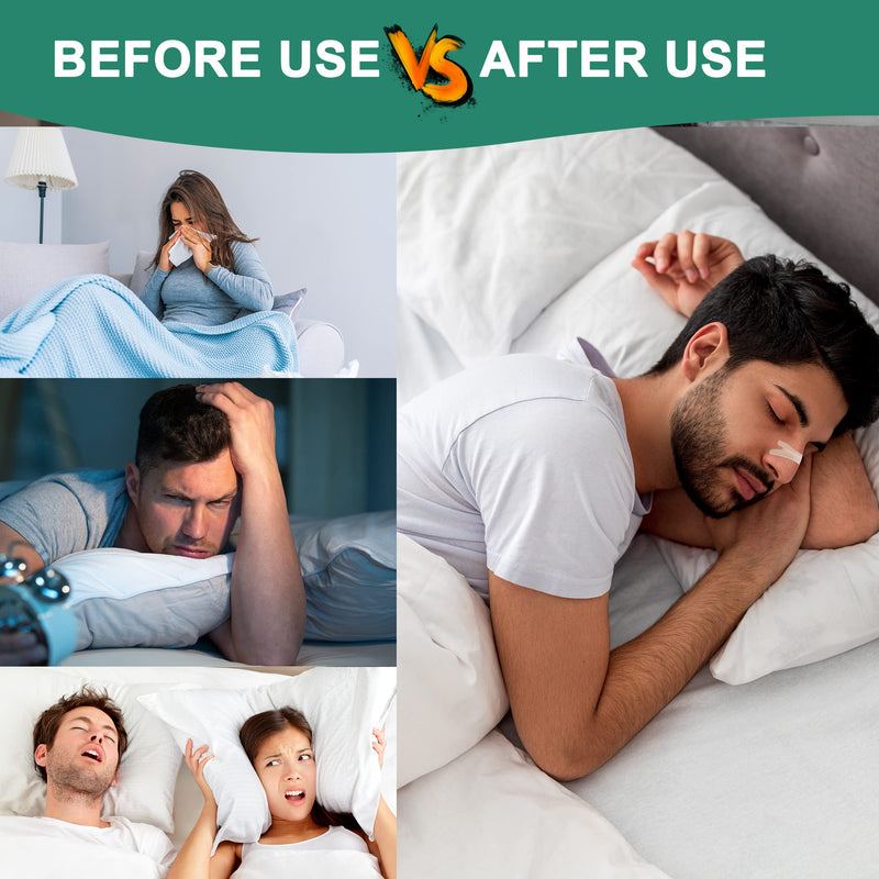[Australia] - Nasal Strips for Snoring, 120 Count Extra Strength Nose Strips for Breathing, Sleep Snore Strips for Men Women, Relieve Nasal Congestion Due to Colds & Allergies, Anti Snoring - Tan 66 mm x 19 mm 