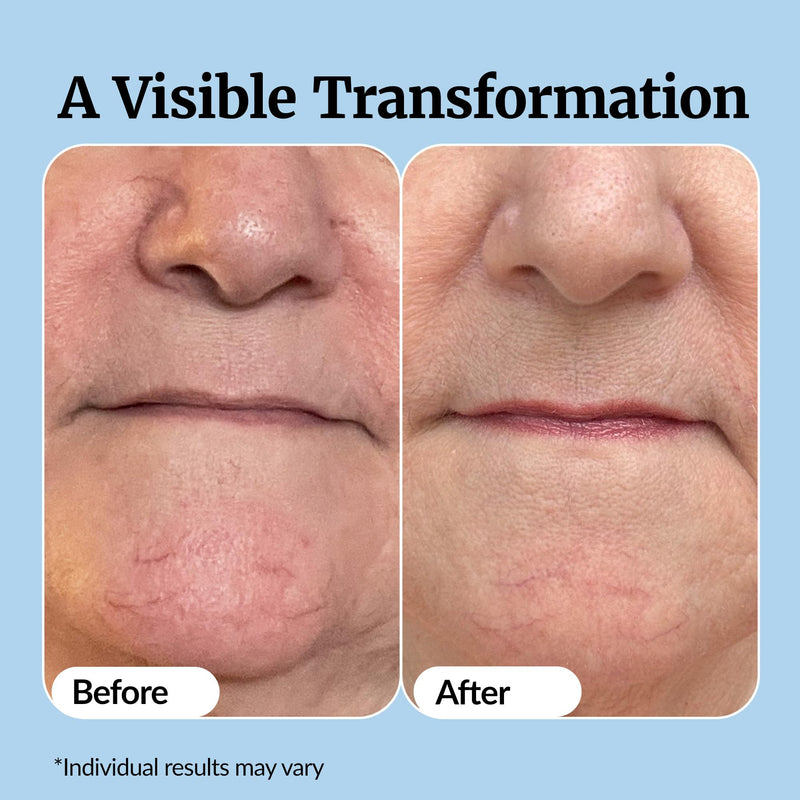 [Australia] - Vibriance Super C Serum for Mature Skin - All-in-One Vitamin Formula Hydrates, Firms, Lifts, Smooths, Targets Age Spots, Wrinkles, 1 fl oz 1 Fl Oz (Pack of 1) 
