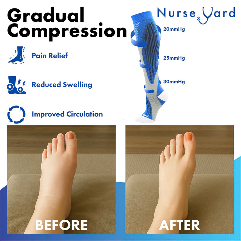 [Australia] - Compression Socks for Nurses - Women & Men - 20-30mmHg Graduated Compression, Zero-Toe Compression, For Medical Staff, Nursing, Athletic Support Such As Running, Cycling, Hiking - 1 Pair Large-X-Large Blue 