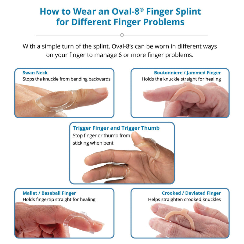 [Australia] - 3-Point Products BEIGE Oval-8 Finger Splints, Support and Protection for Arthritis, Trigger Finger or Thumb, and Other Finger Conditions, 5-Pack, Size 5 Size 5 (Pack of 5) 