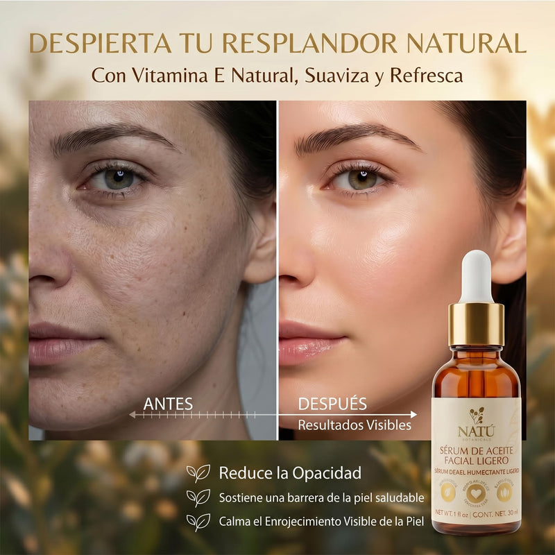 Hydrating Light Face Oil Serum for Oily & Combination Skin - 1 fl oz | No Buildup, No Clogs, No Greasy Feel - Facial Oils with Tea Tree, Coconut Oil & Vitamin E from Sweet Almond 1 Fl Oz (Pack of 1)