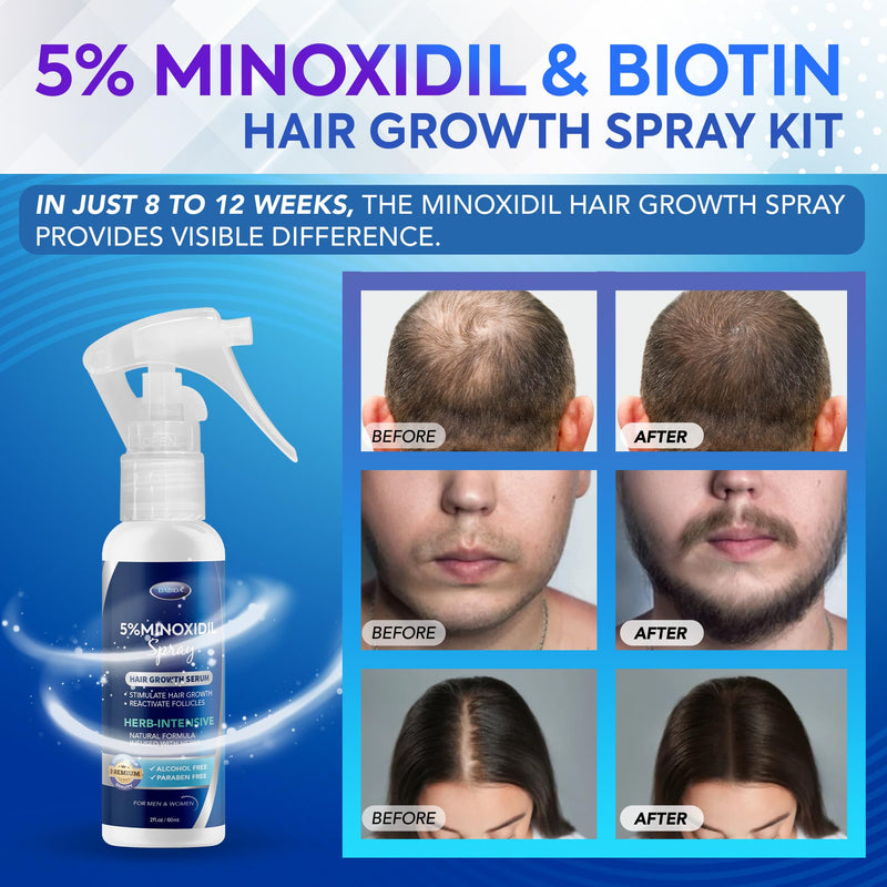 5% Minoxidil for Men and Women Hair Growth Spray, Minoxidil Spray 2oz 3pcs | 5% Minoxidil Hair and Beard Regrowth Treatment for Men and Women with Biotin, Extra Strength Formula for Thicker, Fuller Hair 2 Fl Oz (Pack of 3) Spray 3pcs