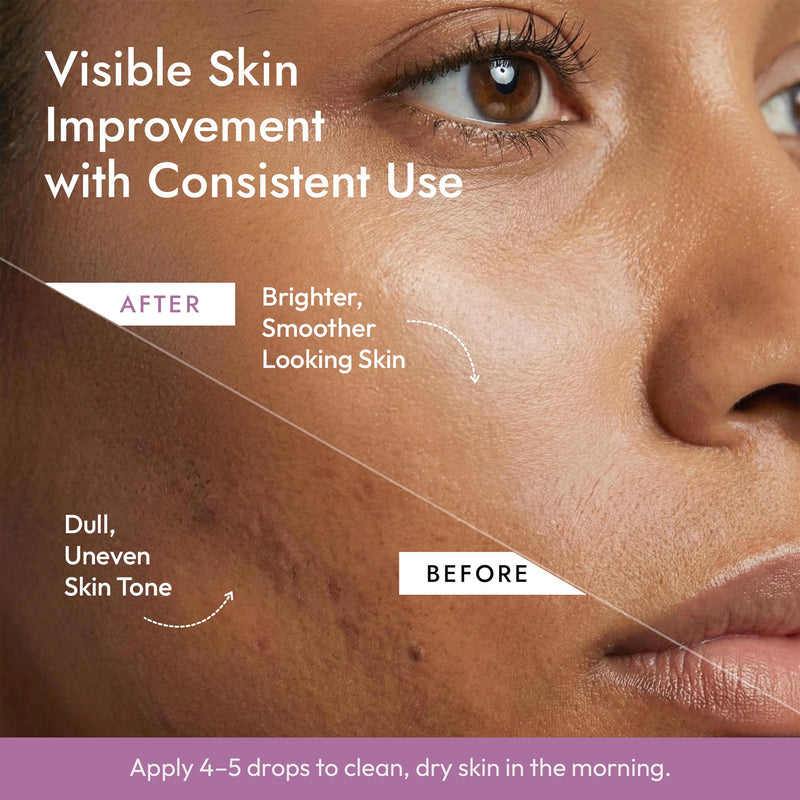 DERMAdoctor Kakadu C 20% Vitamin C Serum for Face, Ferulic Acid, 1 fl oz | Tocopherol + plum antioxidants • Anti aging • Brightens the look of discoloration • Hydrating • Dermatologist formulated Vitamin C - Brightening