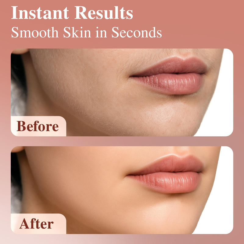 [Australia] - Facial Hair Removal for Women | Upper Lip Mustache Remover Device Face Shaver Woman Chin Peach Fuzz Electric Trimmer Dermaplane Female Razor Ladies Tweezers Lady Epilator Girls by VISOFO (White) White 