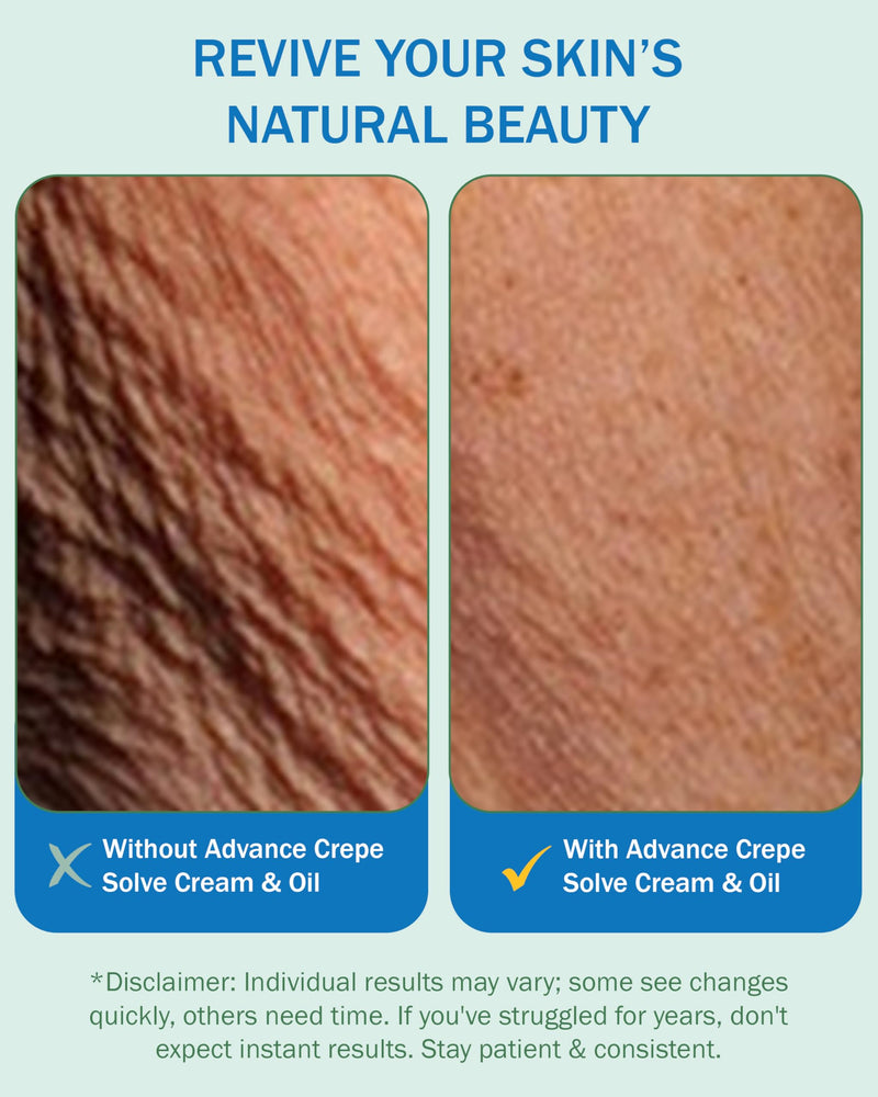 [Australia] - Crepe Cream & Firming Oil Crepe Skin Set, Women & Men - with Natural Oils, Licorice Root & Chamomile Extract - Crepey Skin Tightening Cream & Oil for Body, Made in USA Cream and Oil (Pack of 2) 