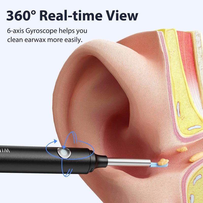 [Australia] - Earwax Remover Otoscope Hopefox 1080P WiFi Ear Cleaner, 360° Wide Angle Otoscope Camera for Adults, Children and Pets with Dust Cover Gray 