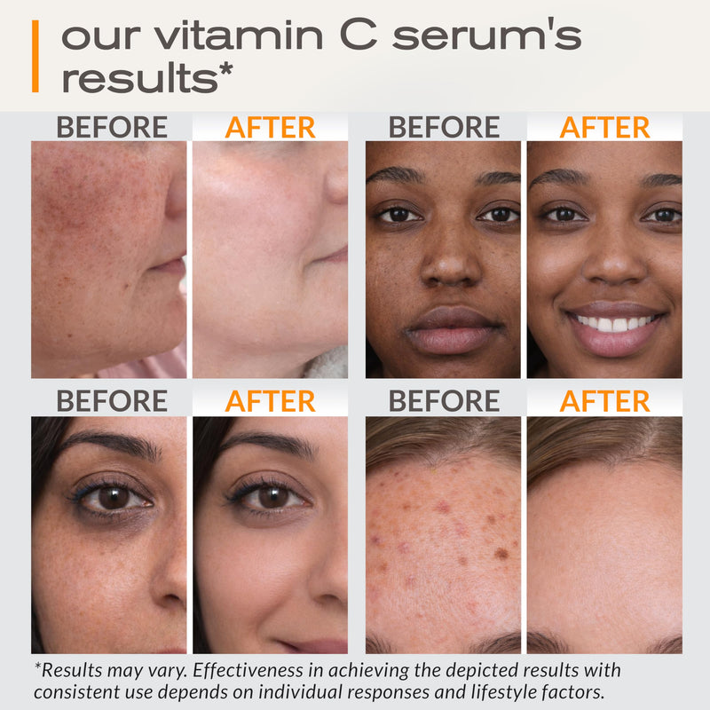 Vitamin C Serum for Face with Hyaluronic Acid, CoQ10 & Aloe Vera, 1 Fl Oz | Vitamin E, CoQ10, Anti-Aging & Skin Brightening, USA Made, Paraben-Free, Fragrance-Free, 1 Fl Oz