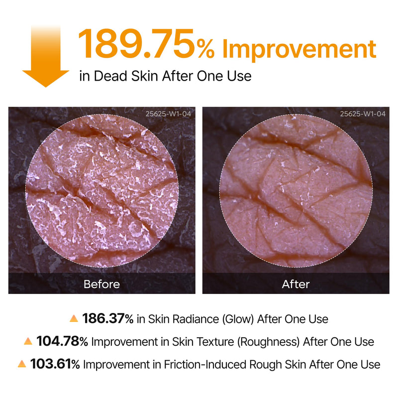 [Australia] - Body Peel Shot Spray Face Peeling Kojic Acid Turmeric Spray 200ml 