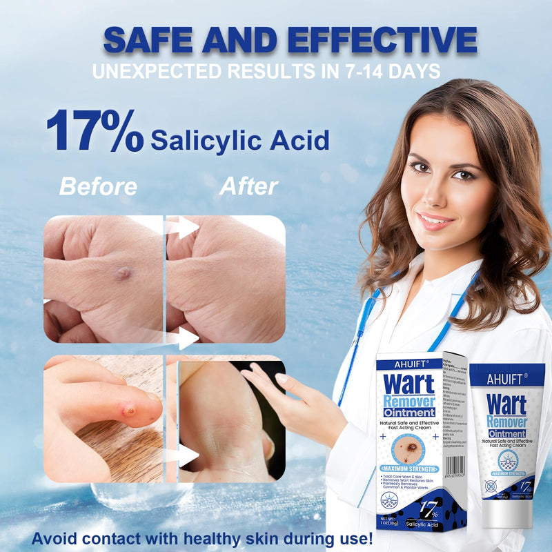 [Australia] - Fast Action Wart Remover Ointment Maximum Strength Cream with Salicylic Acid - Fast-Acting Wart Cream Freeze Off Designed for Warts XK04 