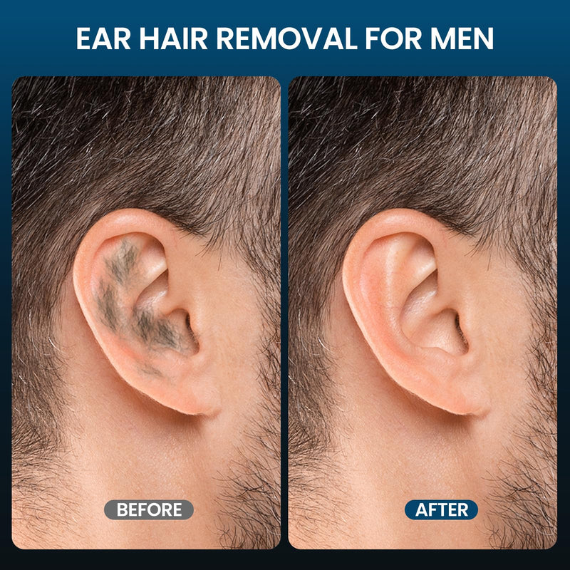 Nose Wax Kit Men, Ear Hair Removal For Men, Ear Hair Waxing Kit with 100 g Wax, 40 Nose Sticks, 20 Times Use, Usb Rapid Heating, Constant Temperature, Painless, Black