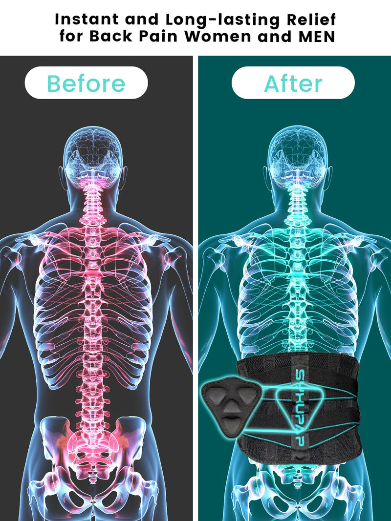 [Australia] - SYXUPAP Back Braces for Lower Back Pain Women and Men, Lumbar Support Belts for Men and Women with Anti-skid Lumbar Strips Pad, For Sciatica, Scoliosis, Heavy Lifting and Work, with Adjustable System XL(Your Waist 39″-47″) Your Weight:195-225lbs 