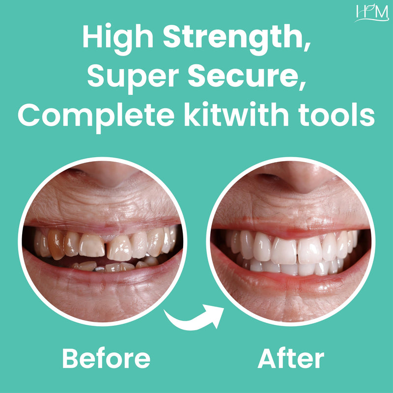 [Australia] - HM Zinc Oxide Eugenol Dental Cement Kit | Super Adhesive | Instant Tooth Repair, Cap, Crown & Bridge Filling | DIY, Self Curing, Sturdy & High Strength |Universal Shade| Emergency Dental Care | 1 Box 
