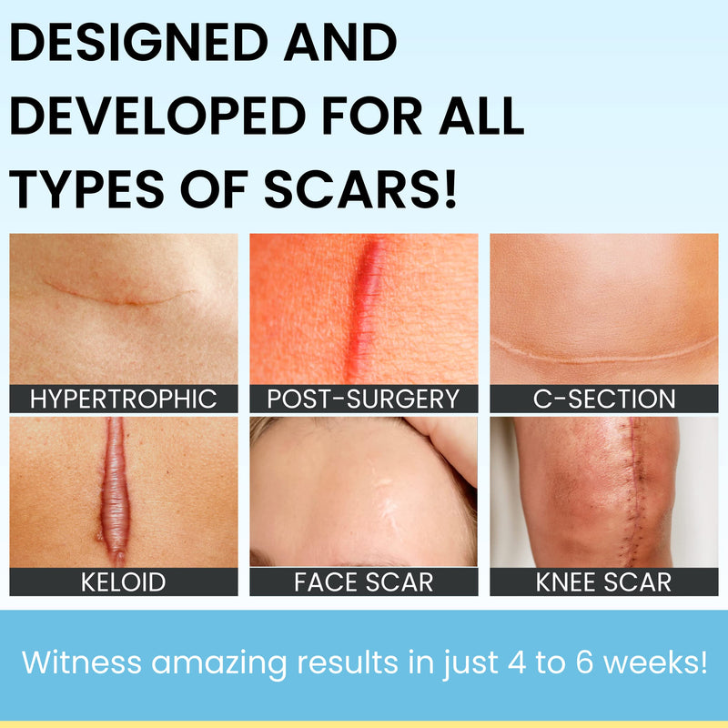[Australia] - Invisible Brush-On Silicone Sheet with Vitamin E - Scar Removal for Keloids, Burn Scars, Surgery Scars, Stitches, Cuts - No Ugly Scar Sheets, Cream or Messy Scar Gel Needed 