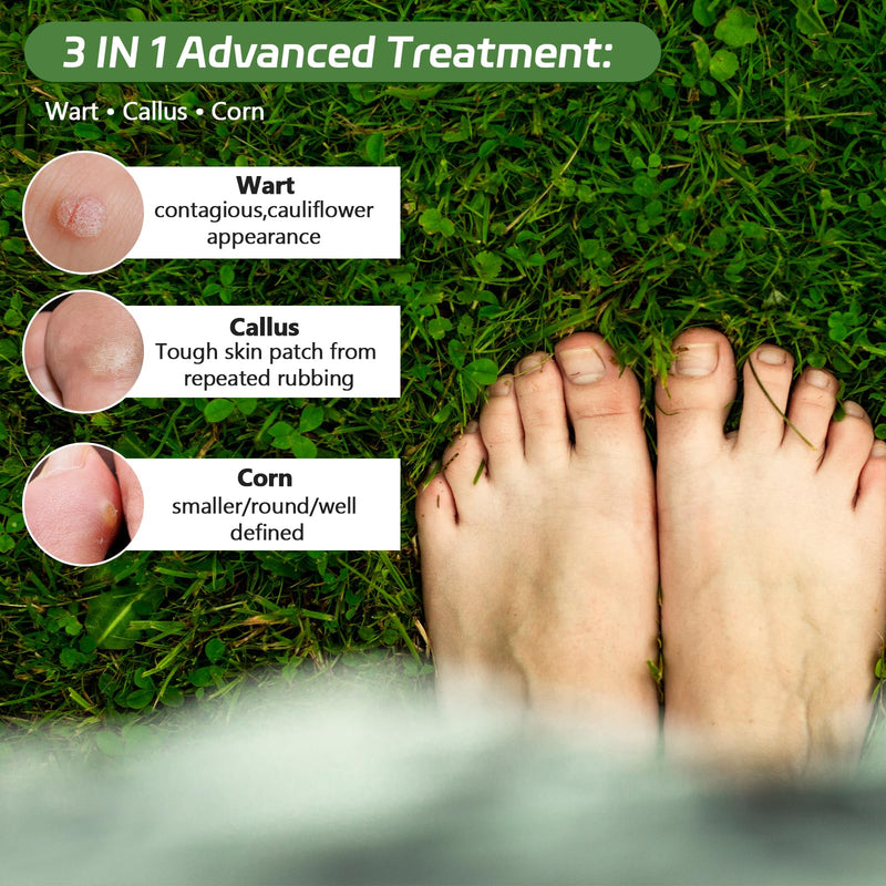 [Australia] - Corn Removers Pads for Feet and Toes, 40% Salicylic Acid Maximum Strength Treatment - Fast Acting Medicated Bandages, Long Lasting Adhesion - 30 Count 30 Count (Pack of 1) 