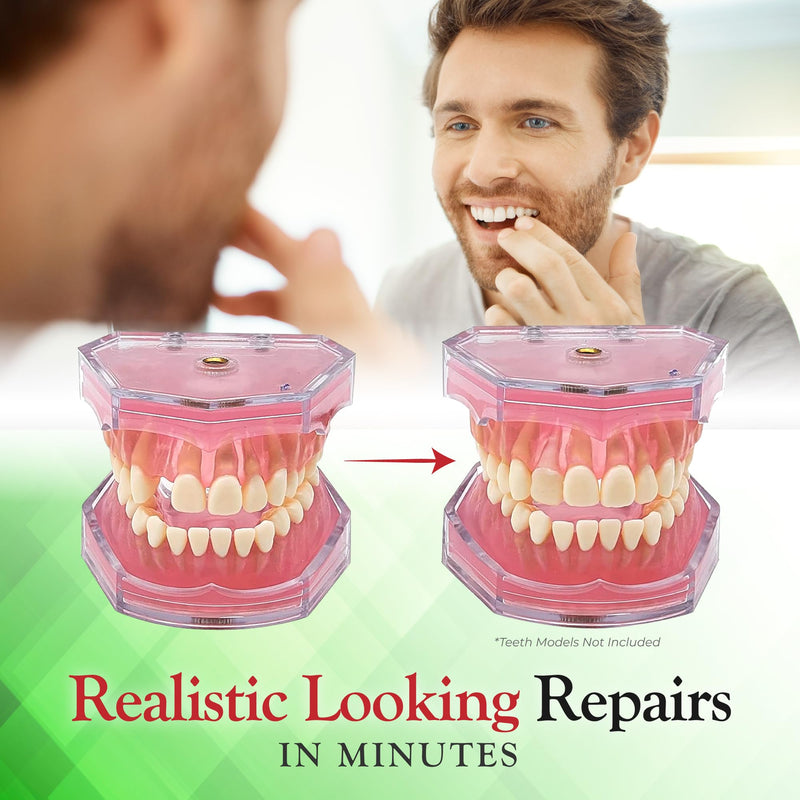 [Australia] - BF Products SmileFix Basic Dental Repair Kit - Durable Compound - for Missing Or Damaged Teeth - Fix Gaps, Broken Tooth, Missing Teeth, Spaces - Repairs - Fast & Easy - Confident Smiles 