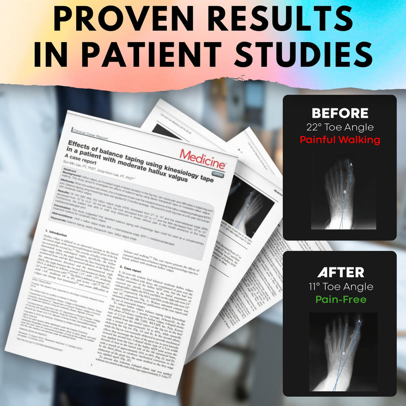 Kinesiology Tape for Moderate Bunions, Big Toe Sprains, Pain Relief and Support | 40 Pre-Cut Applications Included | Hypoallergenic and Sweatproof Kinesio Tape for Toe Joint Support (Pink) Pink