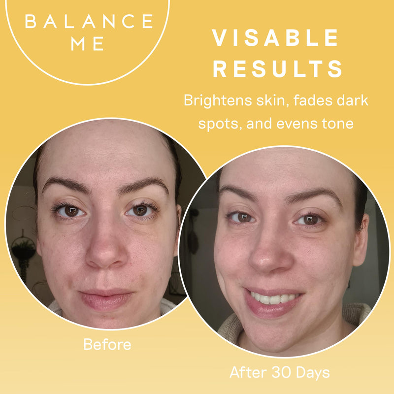 Balance Me Vitamin C Repair Serum, Brightening Face Serum with Hyaluronic Acid, Anti-Aging Vitamin C Serum for Dark Spots, Uneven Tone & Dull Skin, Hydrating & Natural Skincare, (1 x 1.01 fl oz)
