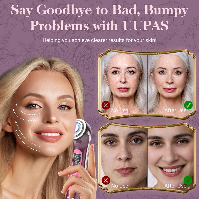 [Australia] - UUPAS Smart Photon Micro-Current LED Red Blue Light Therapy Wand for Face - Microcurrent Facial Device 