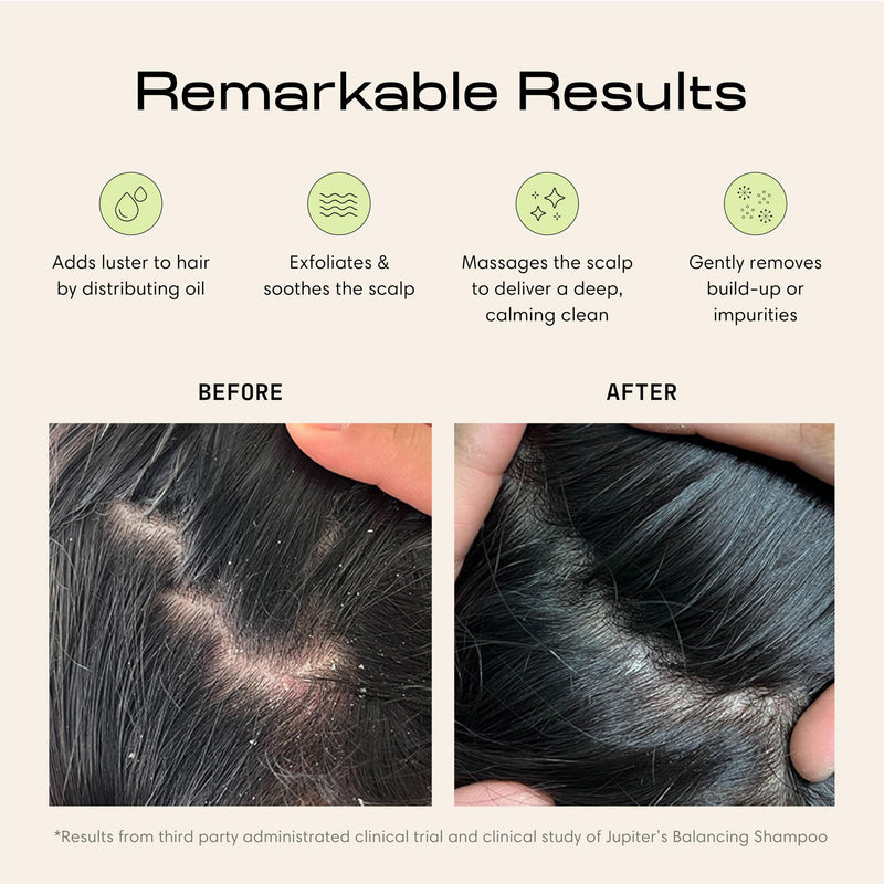 Jupiter Scalp Exfoliator - Scalp Massager Tool for Wet & Dry Hair - Ergonomic Detangler Brush - Dandruff Comb & Scrub to Remove Dandruff & Buildup and Support Circulation - Black/White Black/White 1 Pack