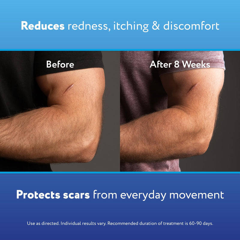 [Australia] - ScarAway Advanced Skincare Silicone Scar Sheets, Medical Grade Silicone Strips, No 1 Recommended Treatment for Surgical, Burn, Body, Acne, Hypertrophic & Keloid Scar Treatment, 8 Tan Reusable Sheets 8 Count 