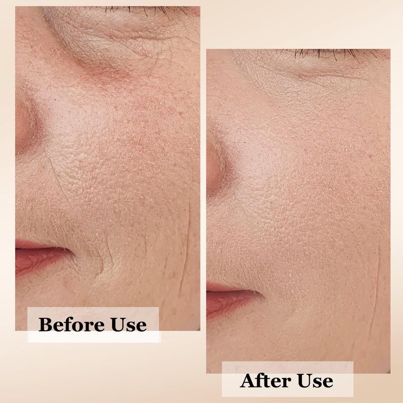 mivida 4-in-1 Anti-Aging Serum for face | Retinol, Vitamin C, Hyaluronic Acid & RoseHip Oil | multi benefit Face Serum – 1 Fl Oz