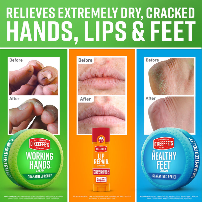 O'Keeffe's Giftbox Including Lip Repair with Cherry and Vitamin E Oil Stick,Working Hands Jar and Healthy Feet Jar,Gift Idea,(Pack of 2) Giftbox (Pack of 2)
